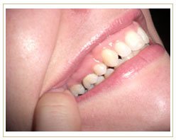 Slider image (4) Dental Retreat